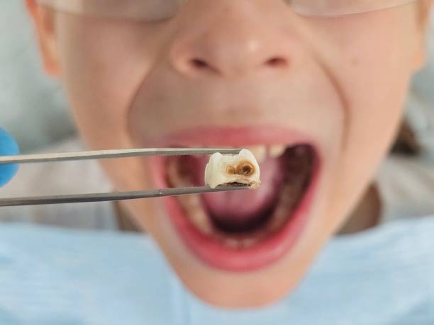 Best Emergency Dental Care for Sports Injuries in Valley Falls, KS