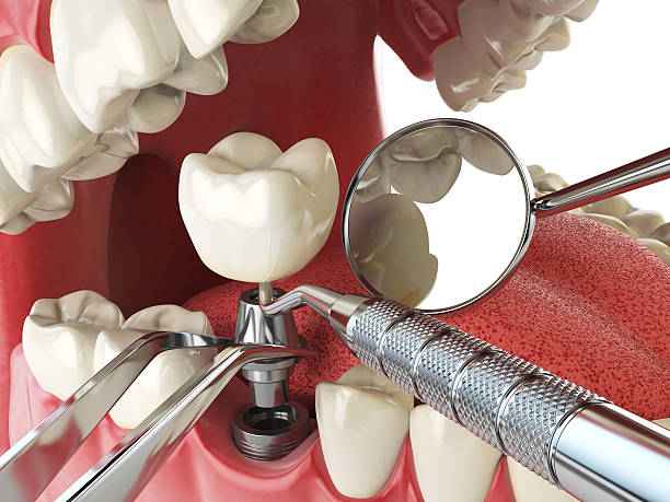 Best Walk-In Emergency Dental Services in Valley Falls, KS